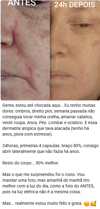 Comparativo Antes e 24h Depois do rosto da cliente, mostrando melhora visível da dermatite atópica, acompanhado de relato em texto sobre alívio de dores em ombros, anca, pés, lombar e ciática.
